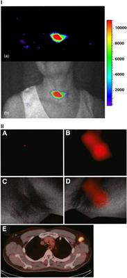 A Review of Recent and Emerging Approaches for the Clinical Application of Cerenkov Luminescence Imaging